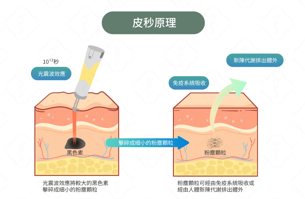 皮秒原理