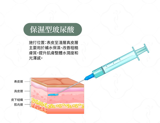 保濕型玻尿酸-水光針注射