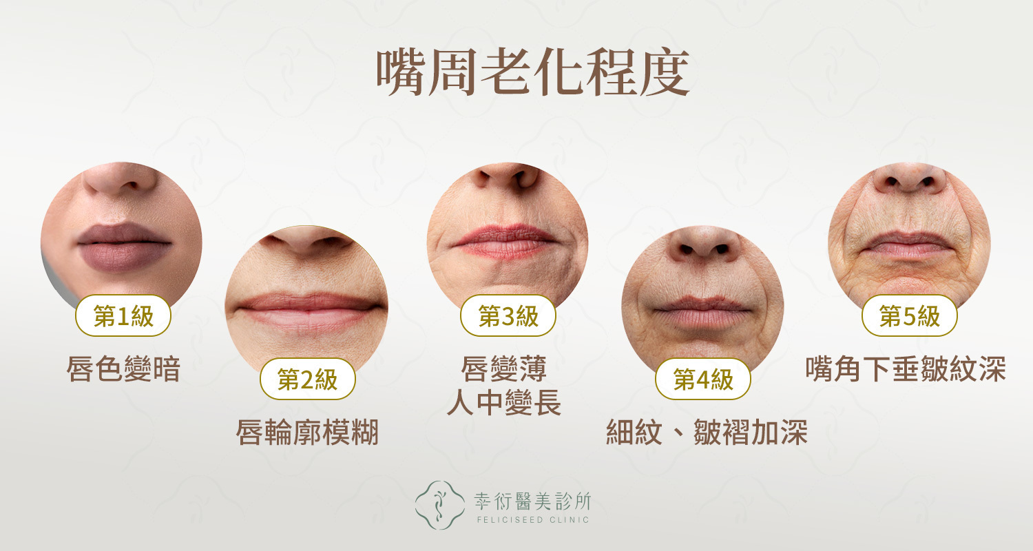嘴周老化程度與改善方式