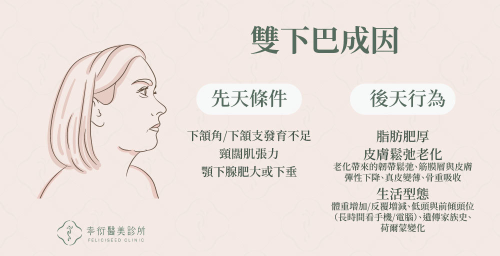 雙下巴成因,雙下巴類型