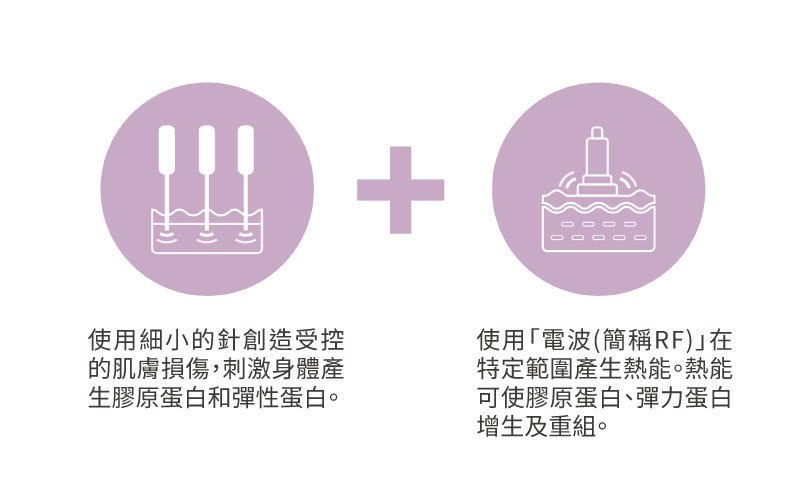 什麼是微針電波？