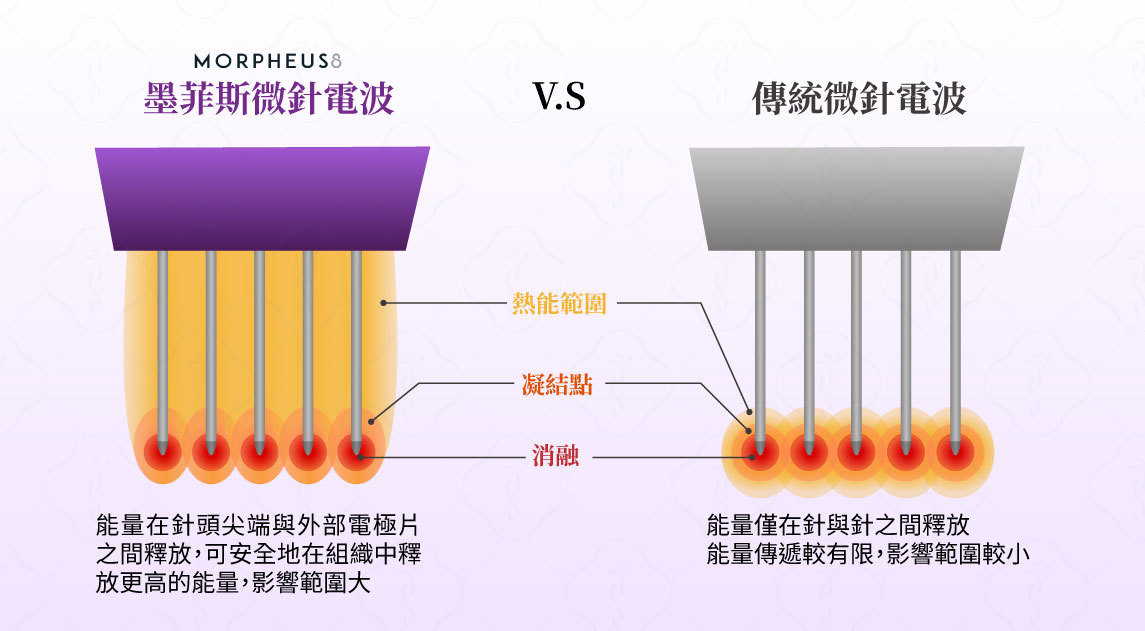 墨菲斯與傳統微針比較