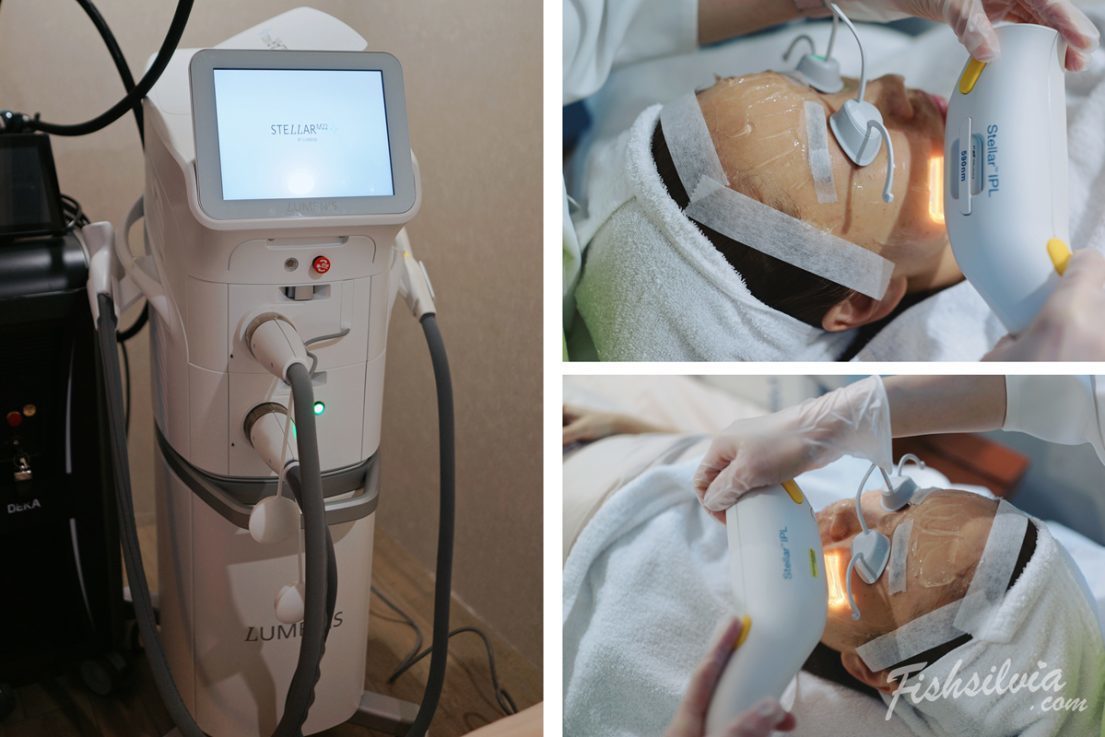 心動光 梭時雷射 醫美療程