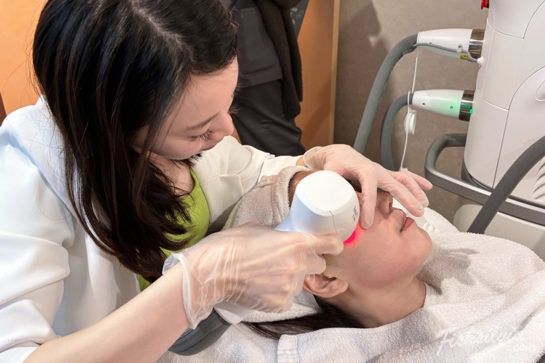 翁子玉醫師施打 梭時雷射