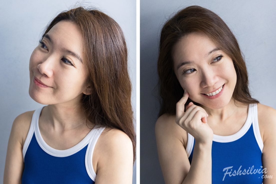 心動光+梭時雷射 術後第1個月