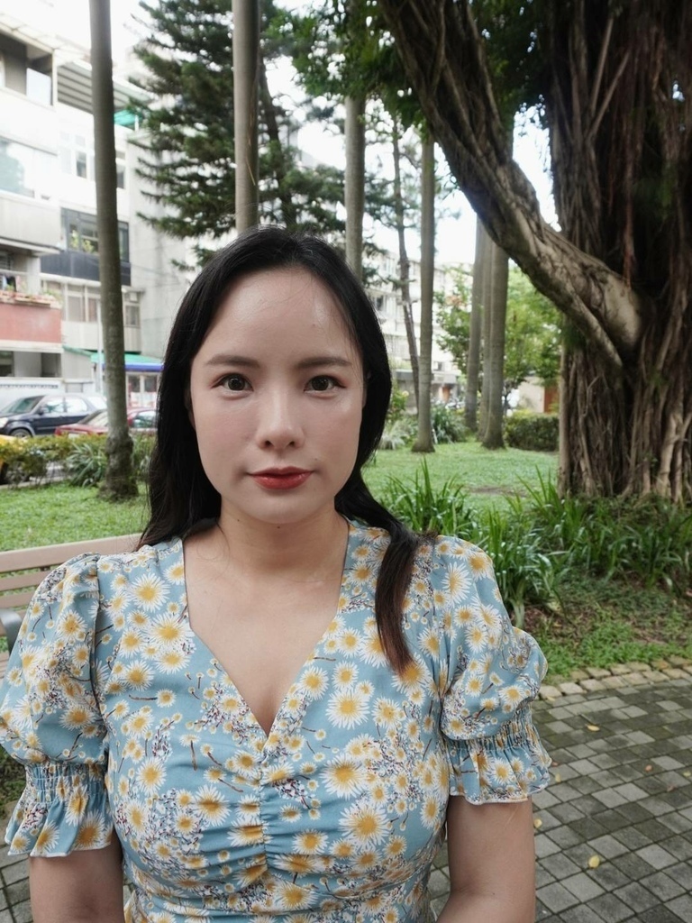 術前生活照 臉型偏方 咀嚼肌明顯 愛菲兒 奇肌肉毒體驗分享